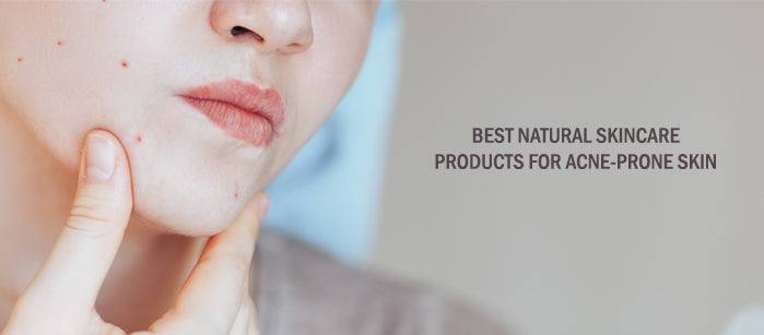 The Best Natural Skincare Products For  Acne-Prone Skin