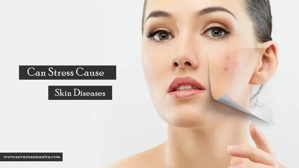 Can Stress Cause Skin Diseases?