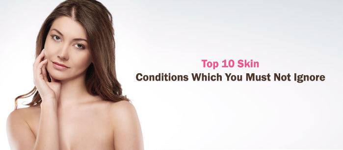 Top 10 Skin Conditions Which You Must Not Ignore - SavarnasMantra