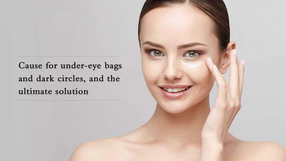 Causes for Under Eye Bags and Dark Circles and the Ultimate Solution - SavarnasMantra