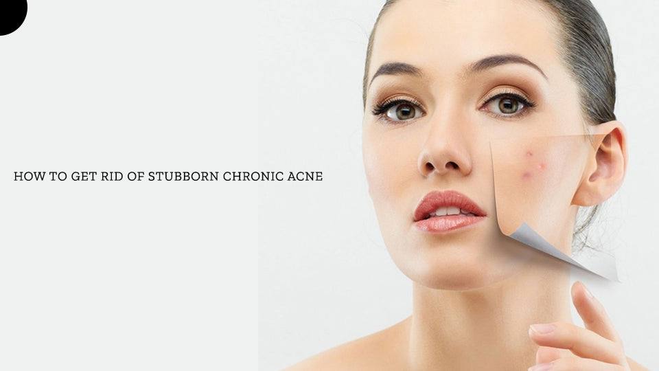 How to get rid of stubborn chronic acne